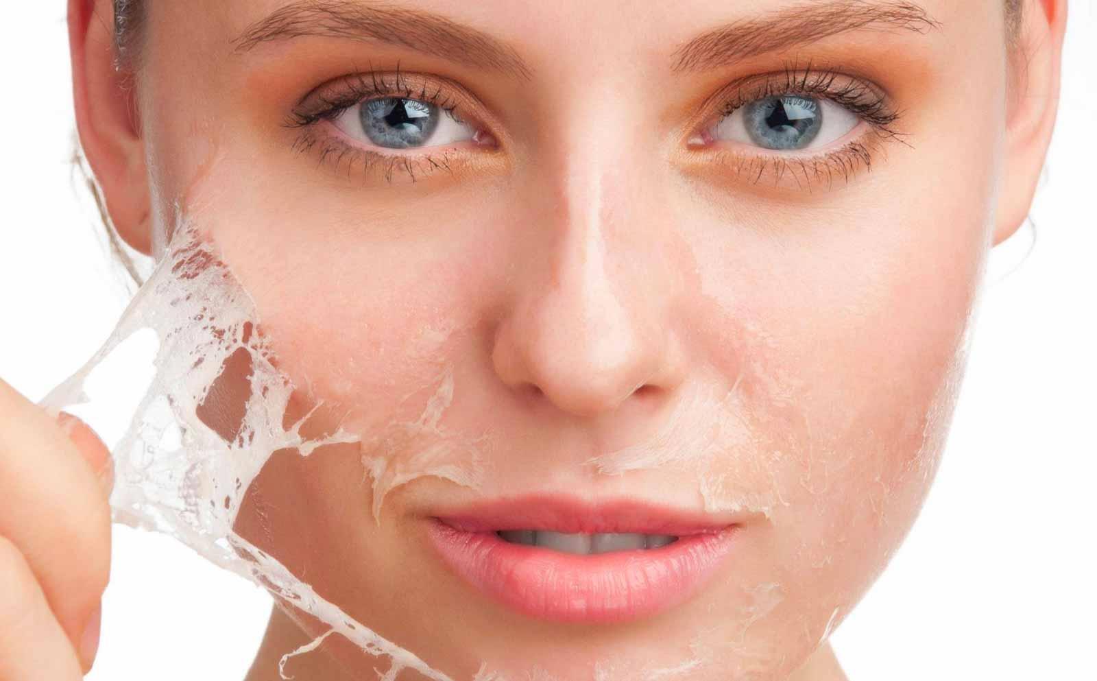 Is Chemical Exfoliation Right For You?